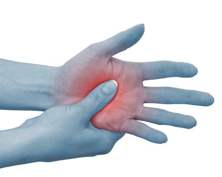 CRPS Hand