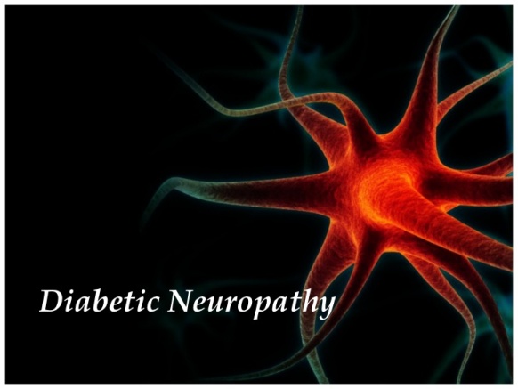 Diabetic-neuropathy-6